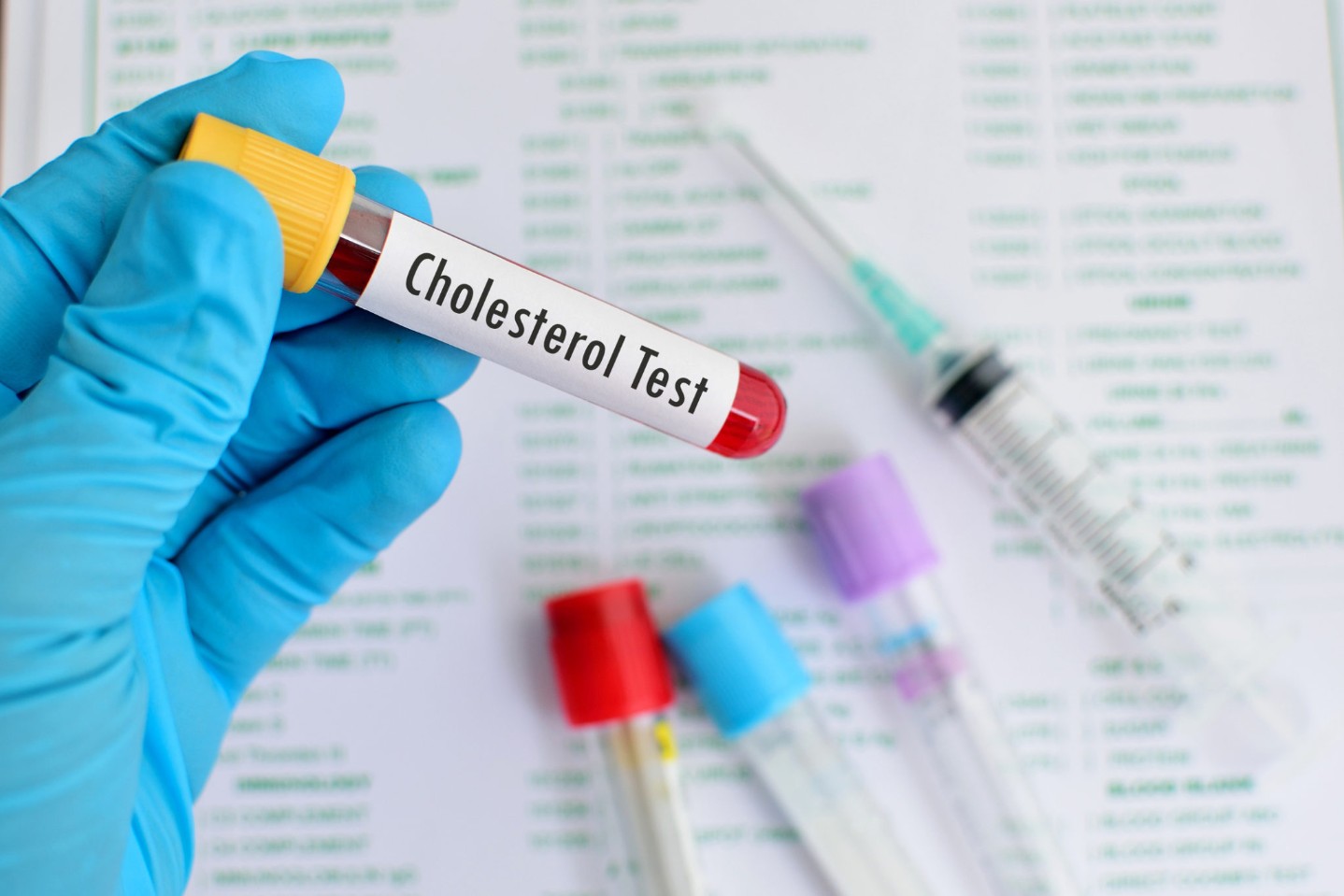 Cholesterol testing