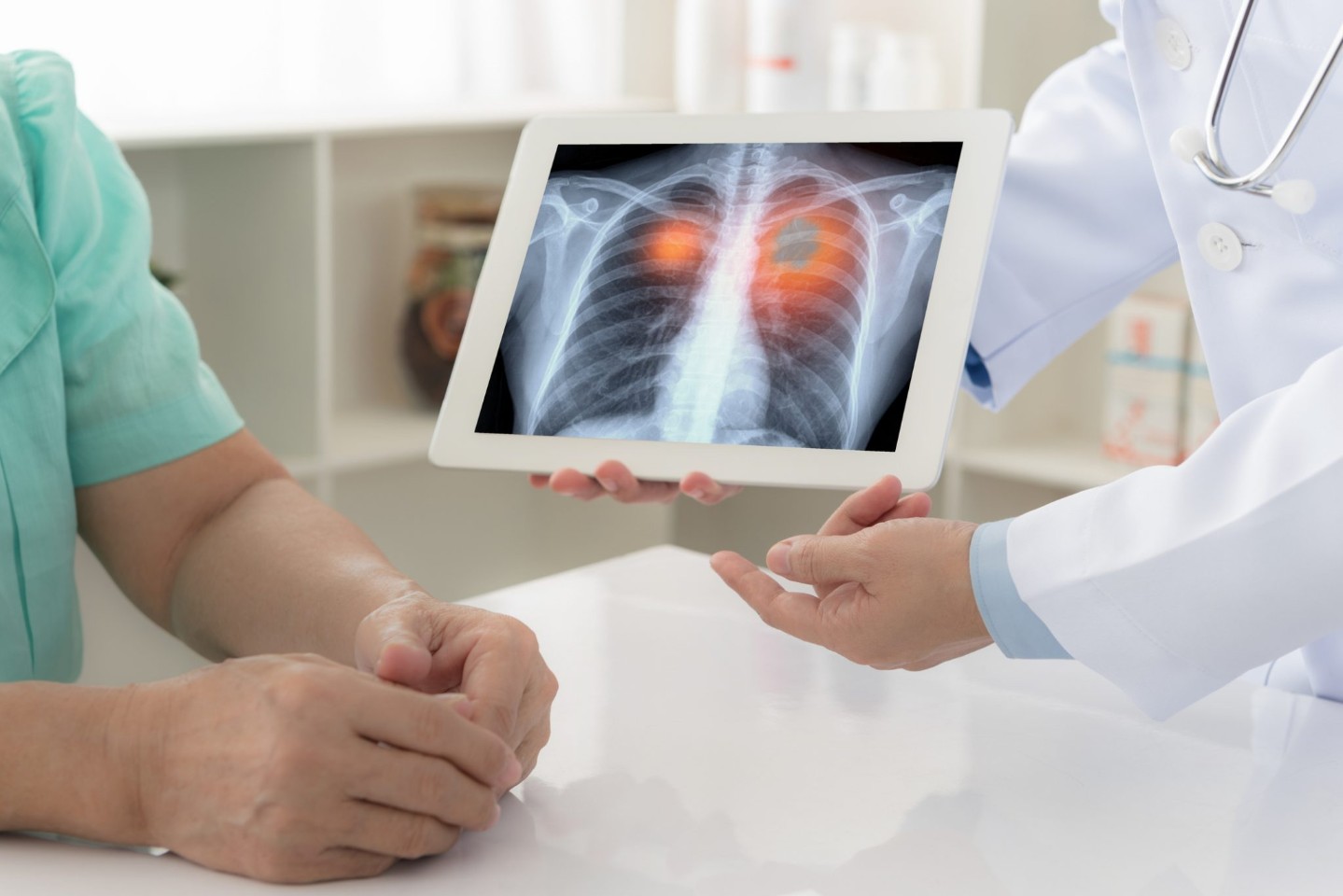 doctor showing patient x-ray of lung cancer